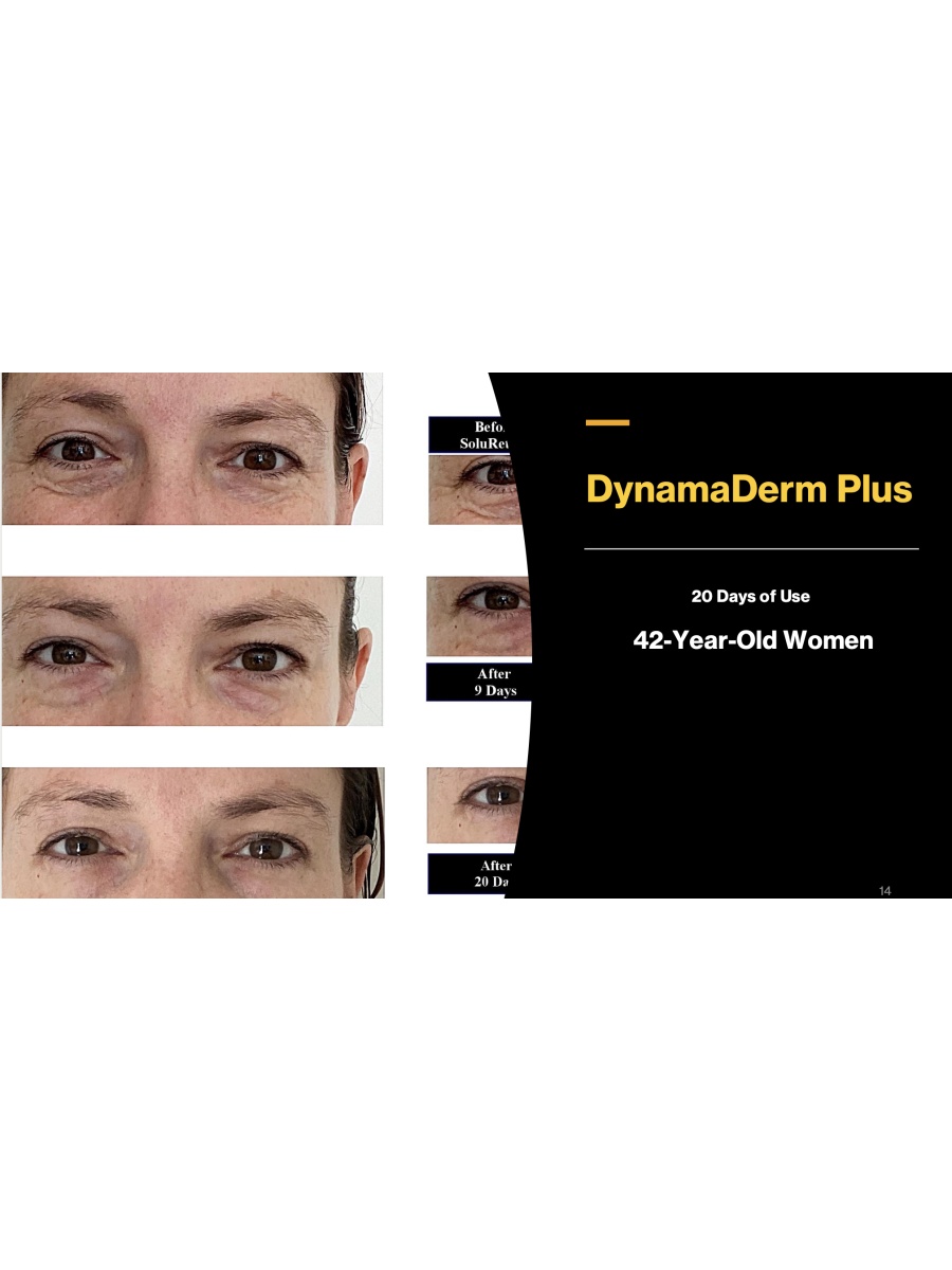 DynamaDerm PLUS  - Water Soluble  CBD / hemp extract  and Retinol