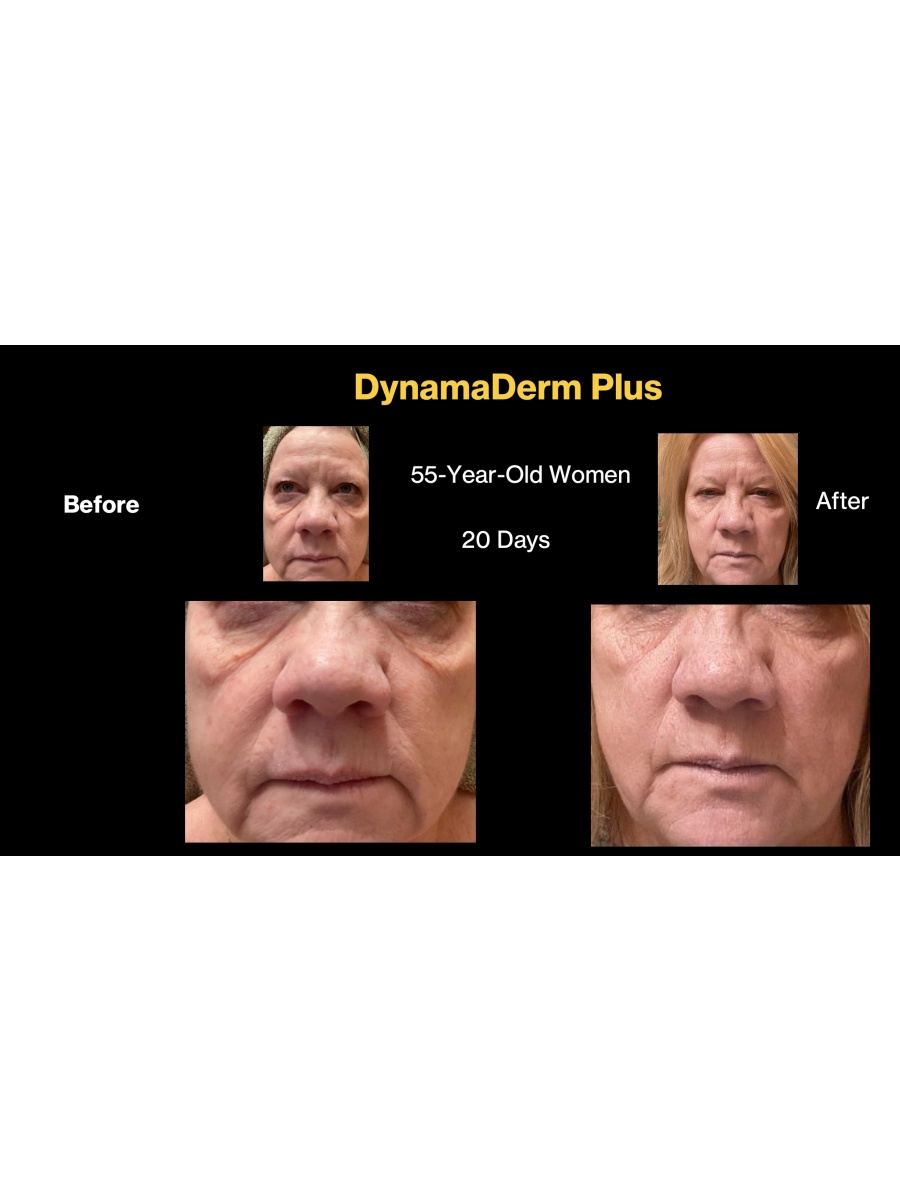 DynamaDerm PLUS  - Water Soluble  CBD / hemp extract  and Retinol