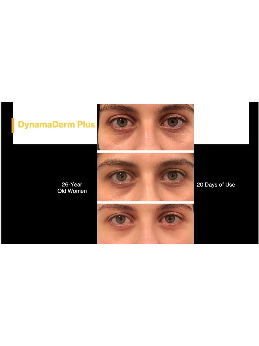 DynamaDerm PLUS  - Water Soluble  CBD / hemp extract  and Retinol